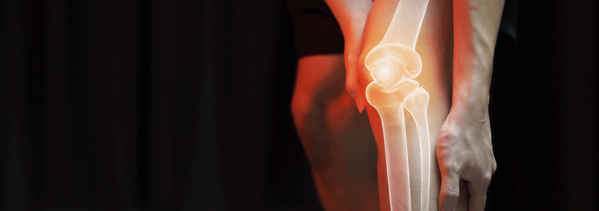 Knee Pain After Hiking