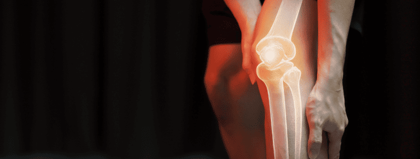 Knee Pain After Hiking